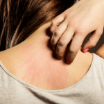 Protein Tozu Alerji Yapar Mı? protein tozu alerji